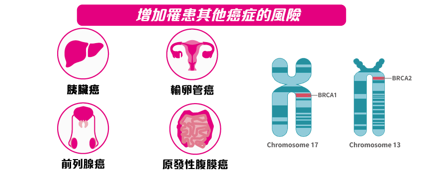 BRCA 基因与乳癌卵巢癌的风险